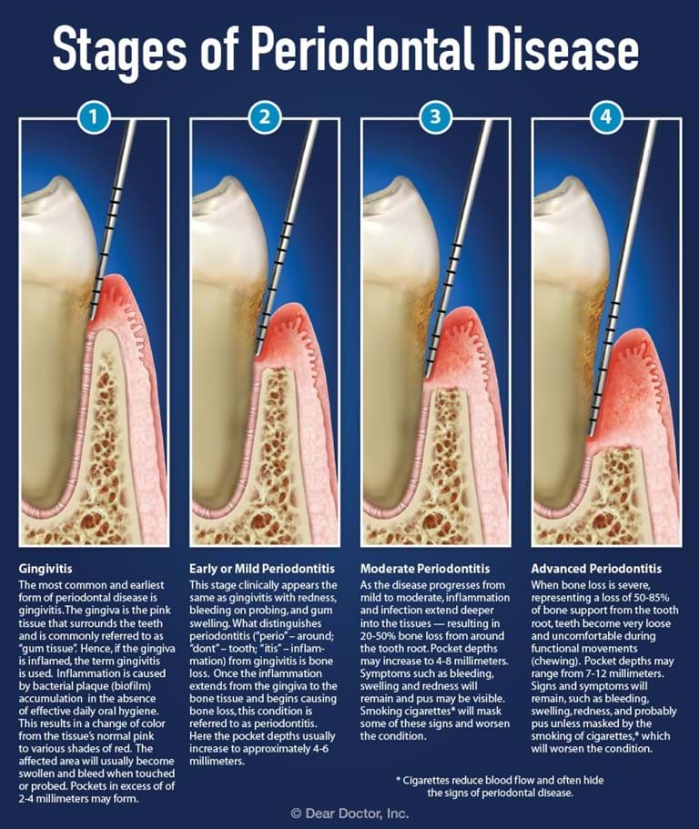 For patients